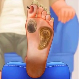 修脚足疔模拟器先行服